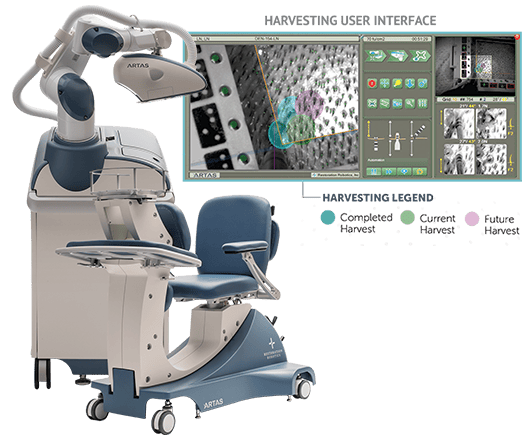 ARTAS Robotic System